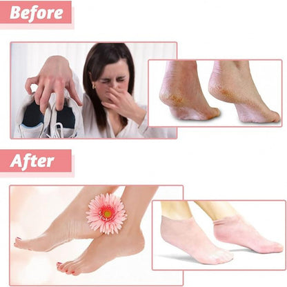 Moisturising Silicone Socks For Dry Cracked Heels