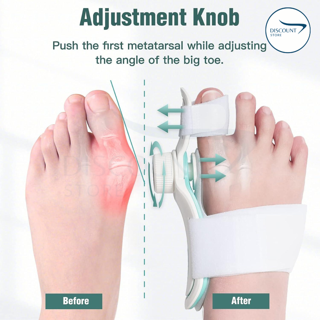 Pain Relief Bunion Toe Corrector - (IMPORTED W/O KNOB)