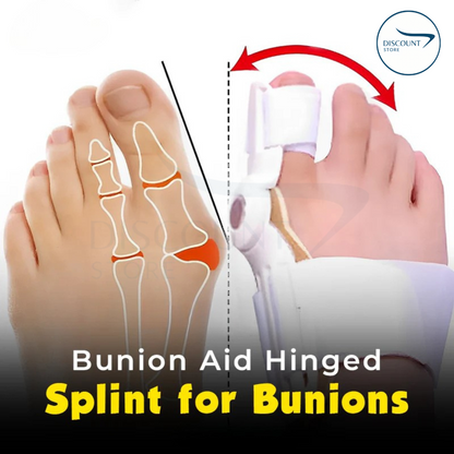 Pain Relief Bunion Toe Corrector - (IMPORTED W/ KNOB)